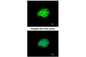 ICC/IF Image Immunofluorescence analysis of paraformaldehyde-fixed A431, using HSPA6, antibody at 1:200 dilution. (HSPA6 antibody  (Center))
