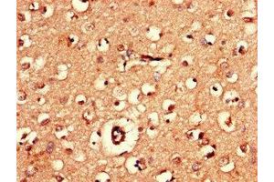 Immunohistochemistry of paraffin-embedded human brain tissue using ABIN7143348 at dilution of 1:100