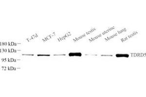 TDRD5 antibody