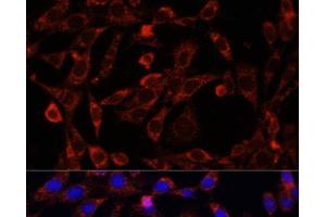 Immunofluorescence analysis of NIH/3T3 cells using UCP3 Polyclonal Antibody at dilution of 1:100. (UCP3 antibody)