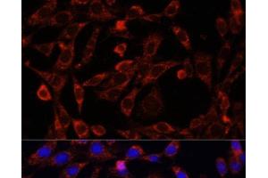 UCP3 antibody