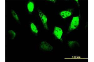 Immunofluorescence (IF) image for anti-Transcription Factor 4 (TCF4) (AA 1-365) antibody (ABIN520754)