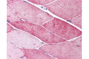 Anti-CAV3 / Caveolin 3 antibody IHC of human skeletal muscle. (Caveolin 3 antibody  (N-Term))
