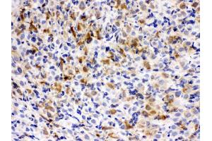 Immunohistochemistry (IHC) image for anti-Chaperonin Containing TCP1, Subunit 5 (Epsilon) (CCT5) (AA 443-535) antibody (ABIN4886515)