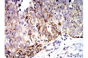 Immunohistochemistry (IHC) image for anti-Superoxide Dismutase 2, Mitochondrial (SOD2) (AA 1-222) antibody (ABIN5888812) (SOD2 antibody  (AA 1-222))