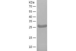 Western Blotting (WB) image for phospholipid Scramblase 1 (PLSCR1) (AA 1-288) protein (His tag) (ABIN7284347) (PLSCR1 Protein (AA 1-288) (His tag))