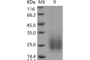 Western Blotting (WB) image for Tetraspanin 7 (TSPAN7) protein (His tag) (ABIN7320122) (Tetraspanin 7 Protein (TSPAN7) (His tag))