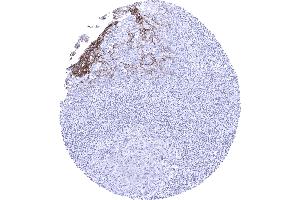 Tonsil In the tonsil a moderate to strong Dsg3 immunostaining occurs in squamous epithelial cells of crypts. (Desmoglein 3 antibody  (AA 379-491))