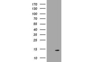 Image no. 3 for anti-D-Dopachrome Tautomerase (DDT) antibody (ABIN1497799)