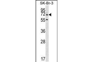 Western blot analysis in SK-BR-3 cell line lysates (35ug/lane). (ZNF398 antibody  (AA 186-215))