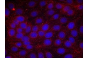 Immunofluorescence staining of methanol-fixed MCF cells using VEGFR2(Phospho-Tyr1214) Antibody. (VEGFR2/CD309 antibody  (pTyr1214))