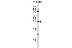 Western Blotting (WB) image for anti-Surfactant Protein C (SFTPC) antibody (ABIN2911136)