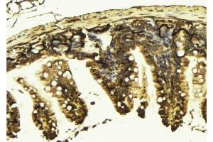 ABIN6277591 at 1/100 staining Mouse colon tissue by IHC-P. (KIF2C antibody  (C-Term))