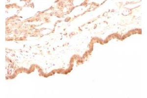 Image no. 1 for anti-Glypican 3 (GPC3) antibody (ABIN6163788) (Glypican 3 antibody)