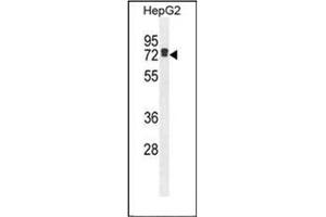 Western blot analysis of LRRC40 Antibody (C-term) in HepG2 cell line lysates (35ug/lane). (LRRC40 antibody  (C-Term))