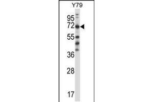 Western blot analysis in Y79 cell line lysates (35ug/lane). (FARSB antibody  (C-Term))