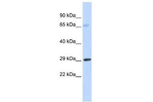 FCER1A antibody used at 1 ug/ml to detect target protein. (Fc epsilon RI/FCER1A antibody  (Middle Region))