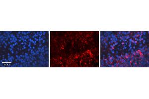 Rabbit Anti-E2F1 Antibody Catalog Number: ARP31171_P050 Formalin Fixed Paraffin Embedded Tissue: Human Lymph Node Tissue Observed Staining: Cytoplasm Primary Antibody Concentration: 1:100 Other Working Concentrations: 1:600 Secondary Antibody: Donkey anti-Rabbit-Cy3 Secondary Antibody Concentration: 1:200 Magnification: 20X Exposure Time: 0. (E2F1 antibody  (Middle Region))
