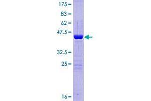 Breast Carcinoma Amplified Sequence 4 (BCAS4) (AA 1-173) protein (GST tag)