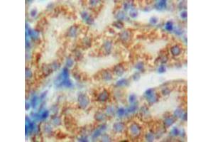 Used in DAB staining on fromalin fixed paraffin-embedded Kidney tissue (PDP antibody  (AA 315-537))