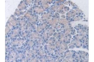 Detection of HGF in Rat Pancreas Tissue using Polyclonal Antibody to Hepatocyte Growth Factor (HGF) (HGF antibody  (AA 306-471))