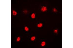 Immunofluorescent analysis of ALX3 staining in HeLa cells. (ALX3 antibody  (Center))