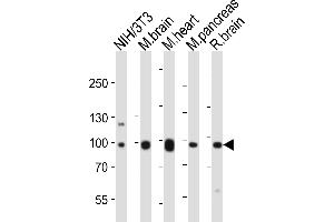 Western blot analysis of lysates from mouse NIH/3T3 cell line, mouse brain, mouse heart, mouse pancreas, rat brain tissue lysate (from left to right), using Ephb1 Antibody (Center) (ABIN6243651 and ABIN6577667). (EPH Receptor B1 antibody  (AA 304-339))