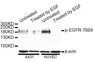 Western blot analysis of extracts of A-431 and HUVEC cells, using Phospho-EGFR-T669 antibody. (EGFR antibody  (pThr669))