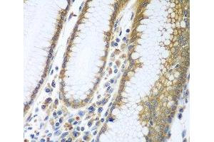 Immunohistochemistry of paraffin-embedded Human stomach using FUT6 Polyclonal Antibody at dilution of 1:100 (40x lens). (FUT6 antibody)