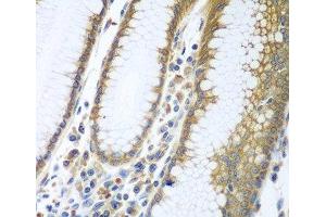 Immunohistochemistry of paraffin-embedded Human stomach using FUT6 Polyclonal Antibody at dilution of 1:100 (40x lens).