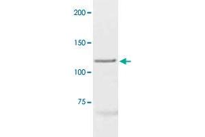 The cell lysate derived from MCF-7 was immunoprobed by PGR polyclonal antibody  at 1 : 500. (Progesterone Receptor antibody  (C-Term))