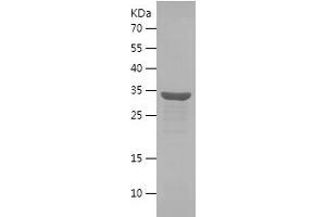 Western Blotting (WB) image for Heterogeneous Nuclear Ribonucleoprotein A2/B1 (HNRNPA2B1) (AA 1-260) protein (His tag) (ABIN7123319) (HNRNPA2B1 Protein (AA 1-260) (His tag))