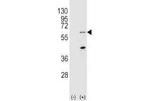 Western blot analysis of PINK1 antibody and 293 cell lysate (2 ug/lane) either nontransfected (Lane 1) or transiently transfected (2) with the Park6/PINK1 gene. (PINK1 antibody  (AA 118-147))