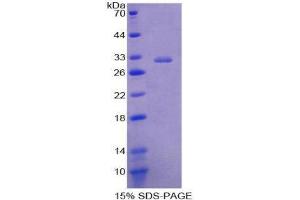 SDS-PAGE (SDS) image for Placental Alkaline Phosphatase (ALPP) (AA 68-313) protein (His tag) (ABIN2123973)
