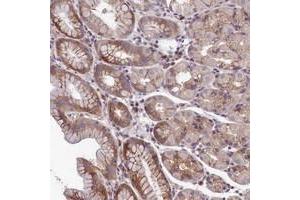 Immunohistochemical staining of human stomach with NLRP14 polyclonal antibody  shows moderate cytoplasmic positivity in glandular cells.