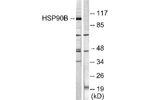 Western blot analysis of extracts from Hela cells treated with TNF-α (20ng/ml, 30min), using HSP90B (Ab-254) antibody (#B0013, Line 1 and 2). (HSP90AB1 antibody  (Ser254))