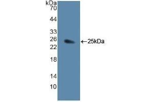 Detection of Recombinant JAG1, Human using Polyclonal Antibody to Jagged 1 (JAG1) (JAG1 antibody  (AA 836-1047))