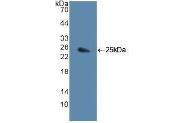 JAG1 anticorps  (AA 836-1047)