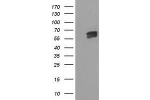 HEK293T cells were transfected with the pCMV6-ENTRY control (Left lane) or pCMV6-ENTRY EXD1 (Right lane) cDNA for 48 hrs and lysed. (EXD1 antibody)