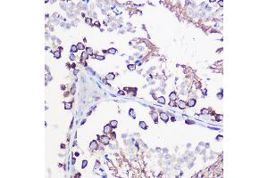 Immunohistochemistry (IHC) image for anti-Deleted in Azoospermia-Like (DAZL) (AA 186-295) antibody (ABIN6139416)