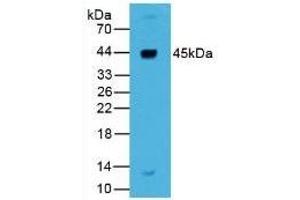 Detection of REN in Human Liver Tissue using Polyclonal Antibody to Renin (REN) (Renin antibody  (AA 67-153))