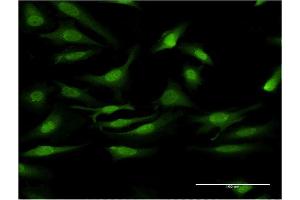 Immunofluorescence of monoclonal antibody to PRKCD on HeLa cell. (PKC delta antibody  (AA 577-676))