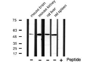 Western blot analysis of extracts of various tissue ,using akt antibody.