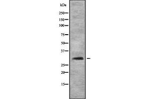 Western blot analysis FHL3 using HT29 whole cell lysates (FHL3 antibody  (Internal Region))