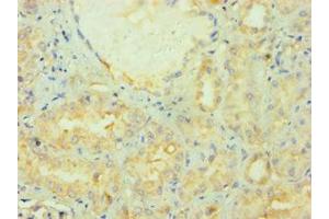 Immunohistochemistry of paraffin-embedded human kidney tissue using ABIN7165066 at dilution of 1:100 (PRMT2 antibody  (AA 1-300))