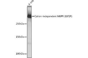 Western blot analysis of extracts of A-549 cells, using Cation-independent Cation-independent M6PR (IGF2R) (IGF2R) Rabbit mAb (ABIN1678848, ABIN3018066, ABIN3018067 and ABIN7101574) at 1:1000 dilution. (IGF2R antibody)