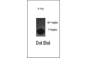 Dot blot analysis of anti-Phospho-cJun-S63 Antibody (ABIN389545 and ABIN2839590) on nitrocellulose membrane. (C-JUN antibody  (pSer63))