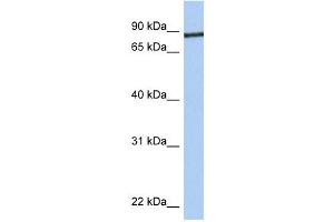 Junctophilin 1 antibody used at 1 ug/ml to detect target protein. (Junctophilin 1 antibody  (C-Term))