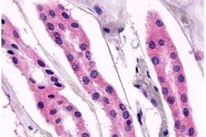 Immunohistochemical (Formalin/PFA-fixed paraffin-embedded sections) staining in human kidney, renal tubules with GPR98 polyclonal antibody . (Gpr98 antibody  (Extracellular Domain))