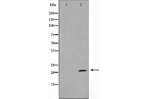 Western blot analysis on Jurkat cell lysate using TPD54 Antibody，The lane on the left is treated with the antigen-specific peptide. (TPD52L2 antibody  (C-Term))